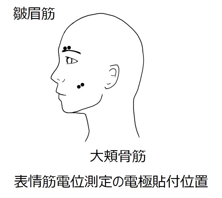 三栄源FFI_プレスリリース画像_表情筋電位測定の電極貼付位置