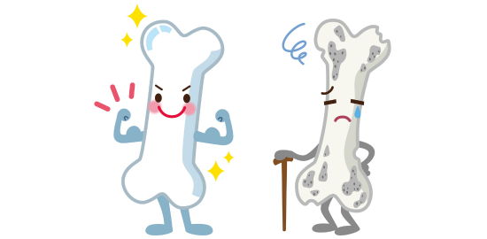 bone_Osteoporosis